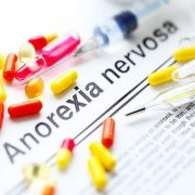 An In-Depth Understanding to Anorexia Nervosa